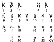 Un caryotype d'homme